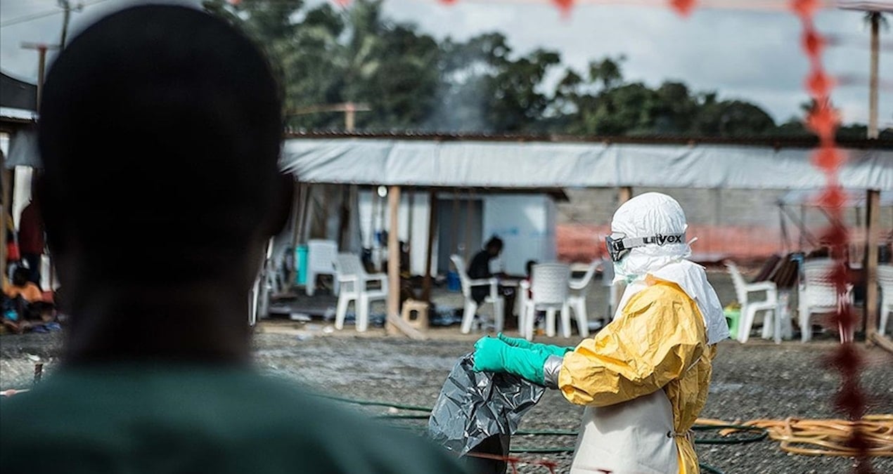 Etiyopya’da ölümcül virüs alarmı: İlk vaka tespit edildi