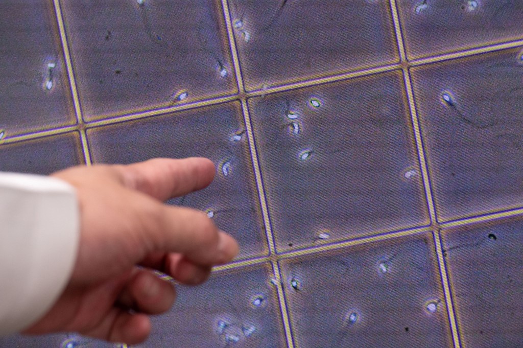 17 yıl sperm bağışladı, doğan bebeklerin 10’u kanser, bazıları öldü