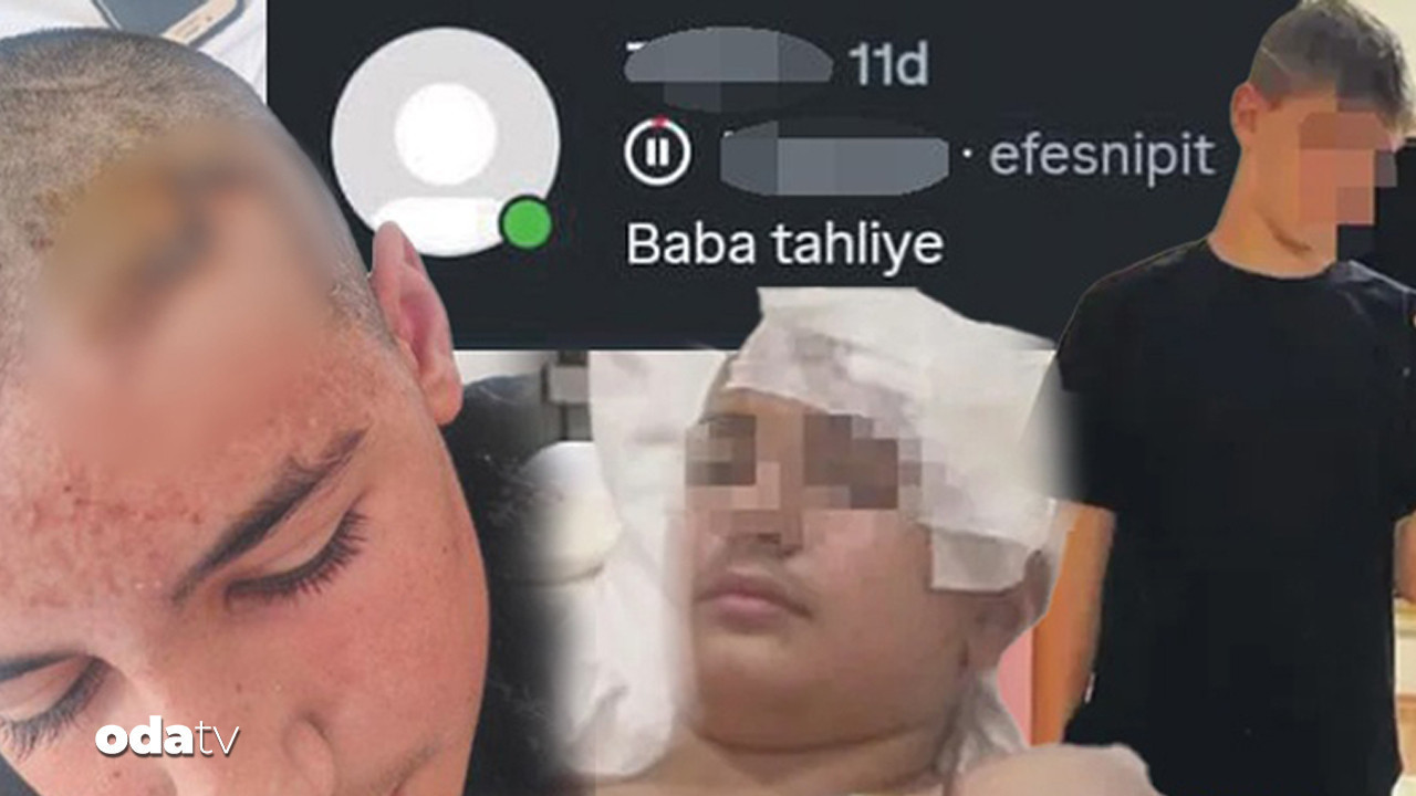Kafatası kırıldı, beyin zarı yırtıldı… Antrenman çıkışı taşlı saldırı: ‘Baba tahliye’
